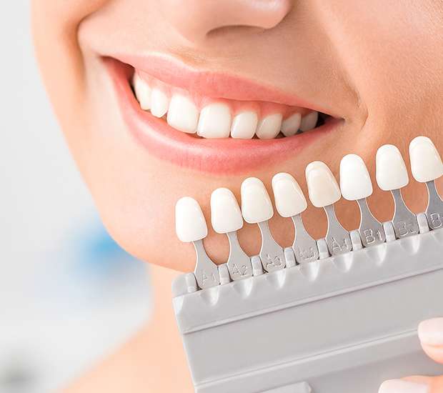 Chicago Veneers